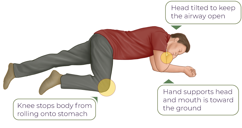 Recovery Position Step By Step Guide 6432