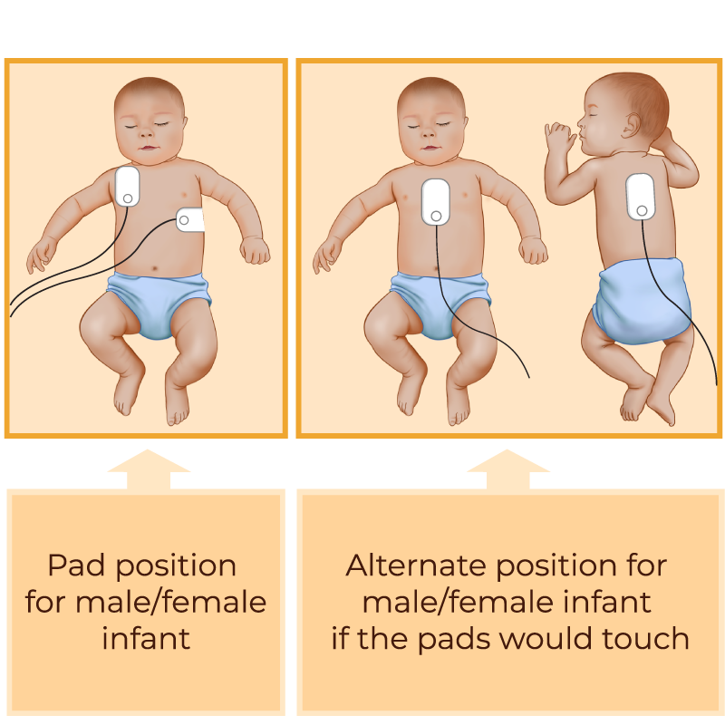 CPR for Infants (up to 12 months) Step by Step Guide