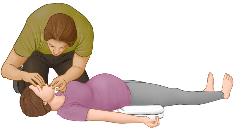CPR Guide - pregnant woman - open airways