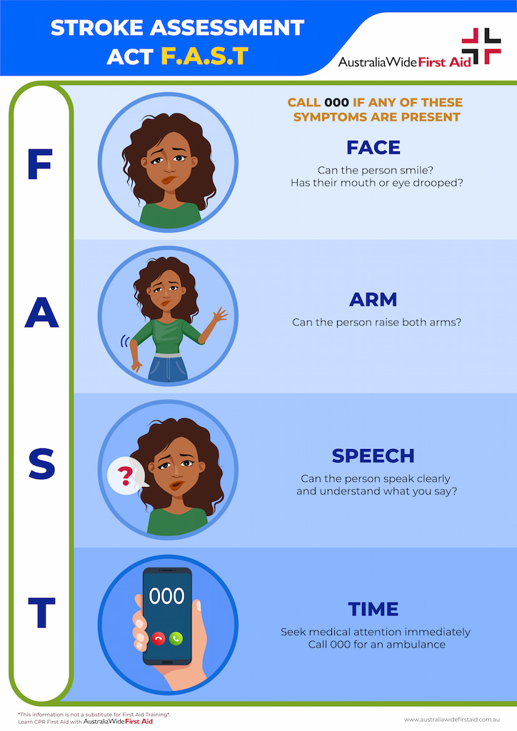 Stroke assessment FAST test